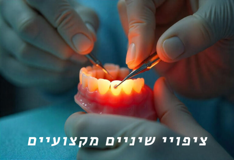 דר רואד ציפויי שיניים חרסינה